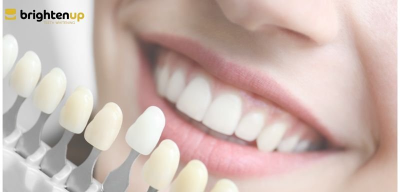 BrightenUp Teeth Whitening